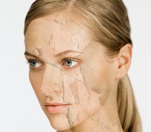 Woman with cracked and peeling skin, Image: 29544052, License: Royalty-free, Restrictions: Specifically, you may not use the Images in ways or contexts that might reasonably be construed as pornographic, defamatory, libellous or otherwise unlawful; Specifically, you may not use images depicting any model in any unduly controversial or unflattering context, unless accompanied with a statement indicating that the person is a model and the images are being used for illustrative purposes only., Model Release: yes, Credit line: Profimedia, ImageSource