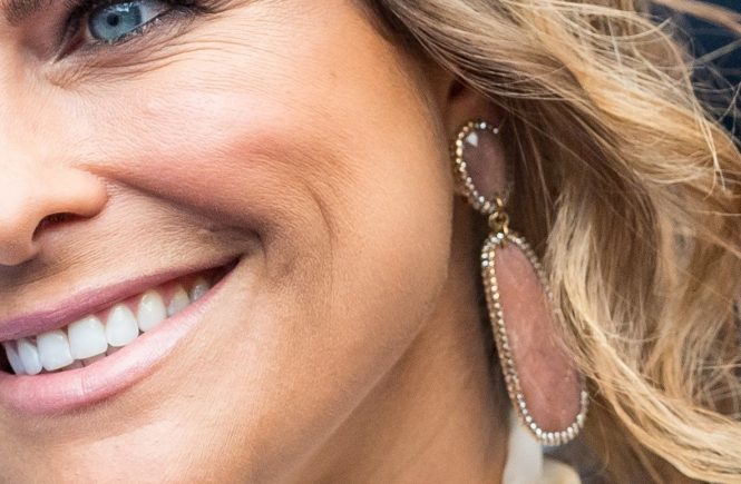 Princess Madeleine earrings / Ã¶rhÃ¤ngen. The Swedish Royal Family was attended at the Polar Music Prize in Stockholm today at Royla Misuc Hall in Stockholm, Sweden. Pictures from the arrival to the red carpet, that was blue. Stockholm, Sweden 2017-06-15 (c) Pelle T Nilsson/Stella Pictures, Image: 337935187, License: Rights-managed, Restrictions: , Model Release: no, Credit line: Profimedia, Stella Pictures - daily