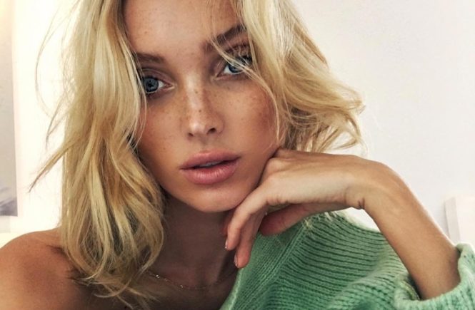 Elsa Hosk releases a photo on Instagram with the following caption: "Freckly ud83dudc35"., Image: 354153465, License: Rights-managed, Restrictions: *** No USA Distribution *** For Editorial Use Only *** Not to be Published in Books or Photo Books *** Handling Fee Only ***, Model Release: no, Credit line: Profimedia, SIPA USA