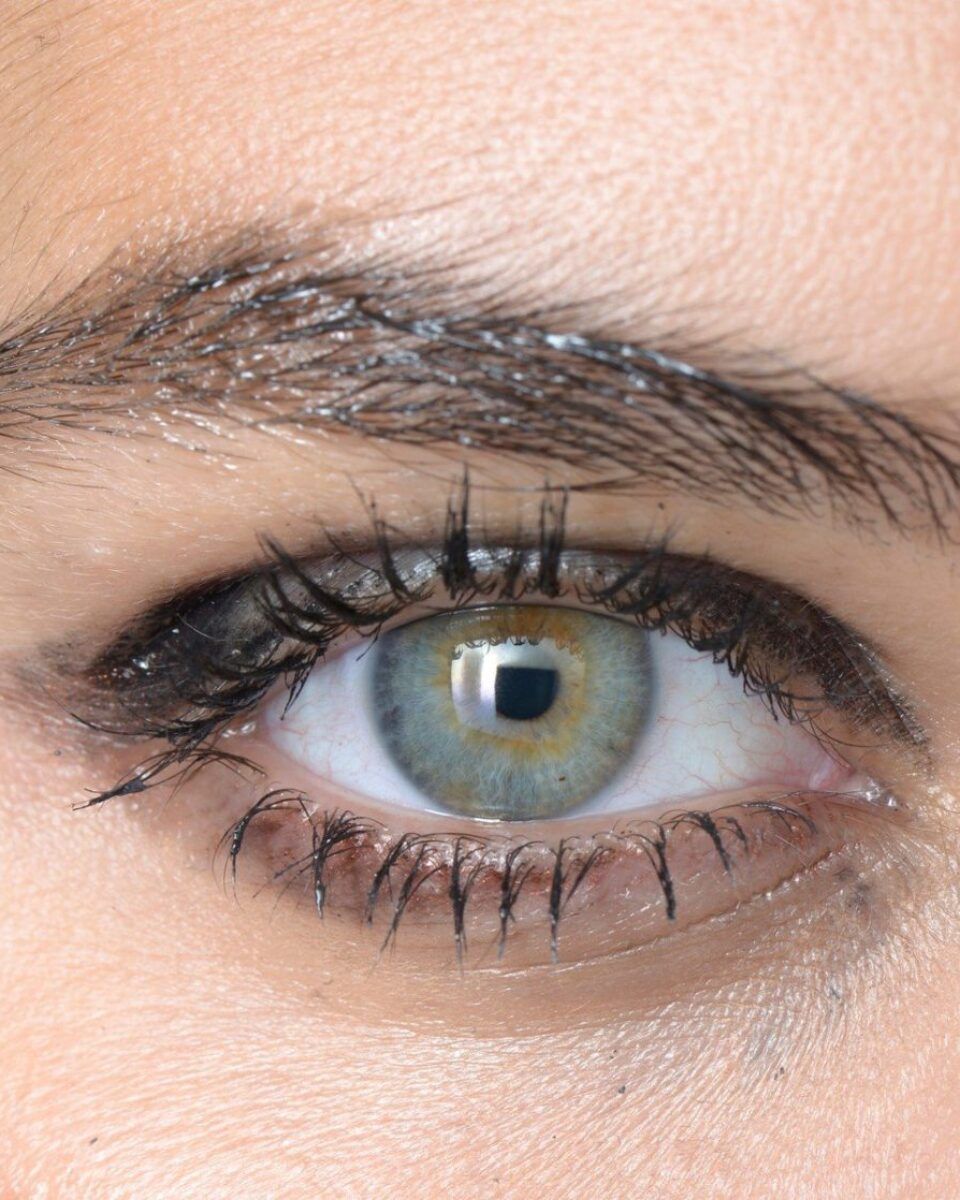 Blefaroplastikom do ljupkog pogleda