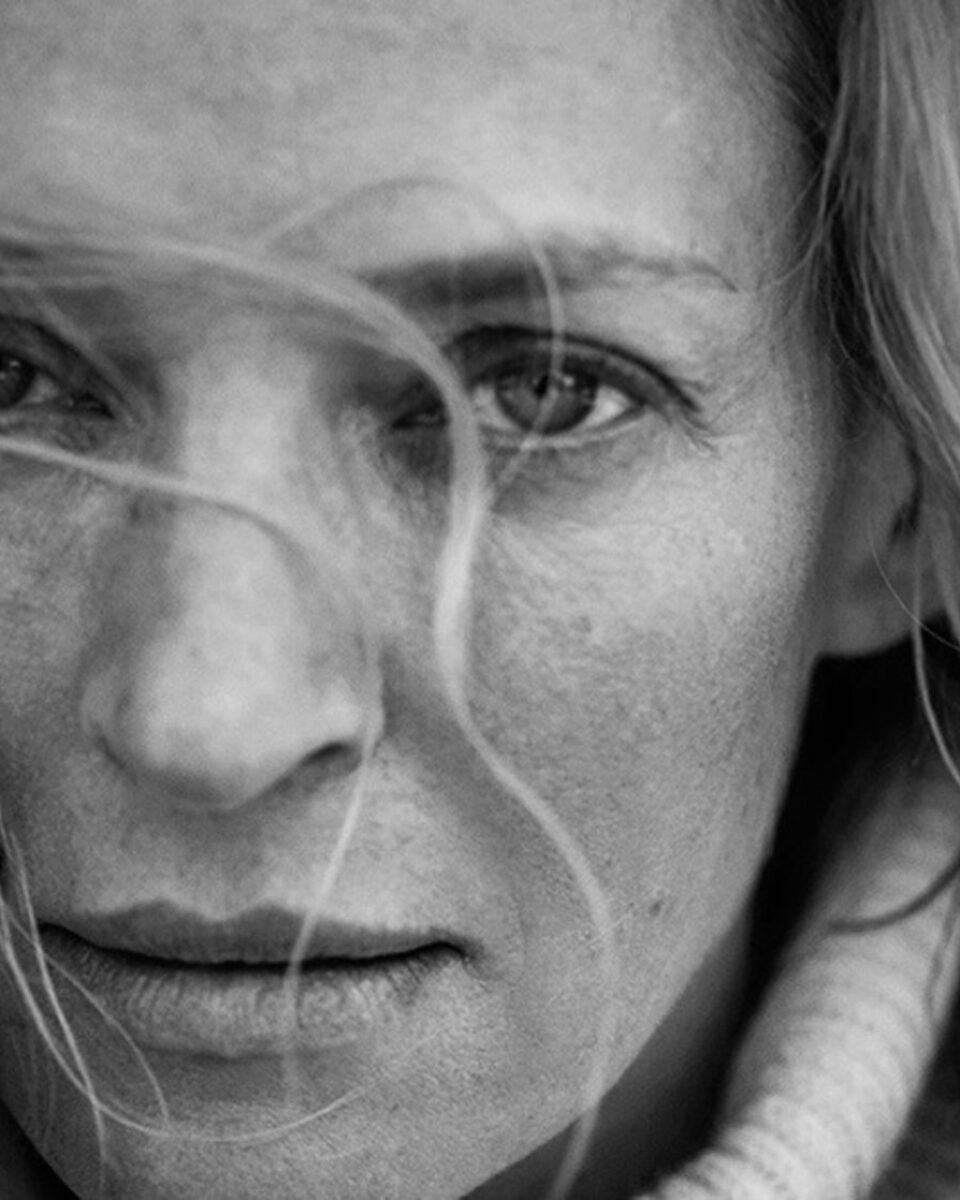 Pomlađivanje kože laserom