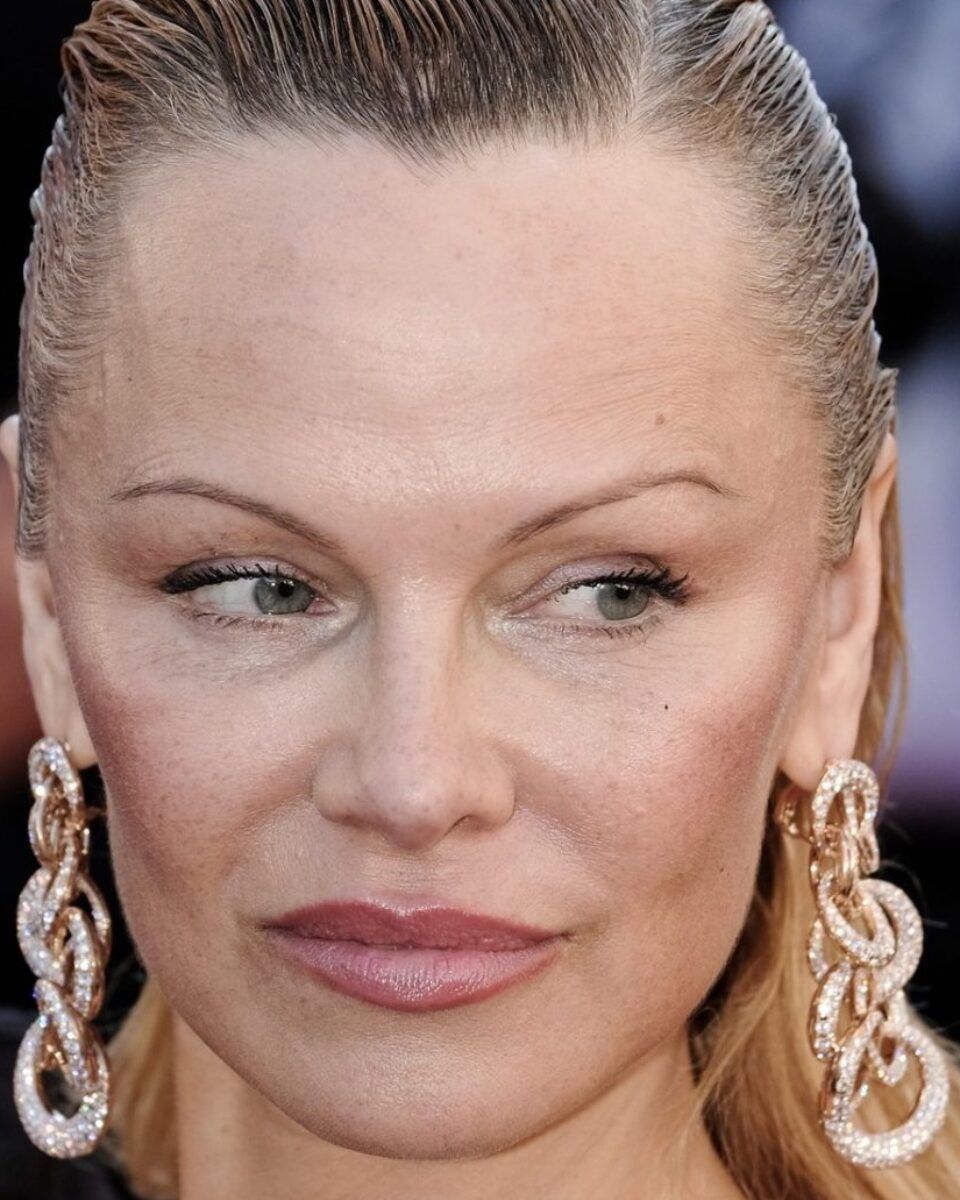 Dr. Željana Bolanča: Koje promjene krije lice Pamele Anderson?