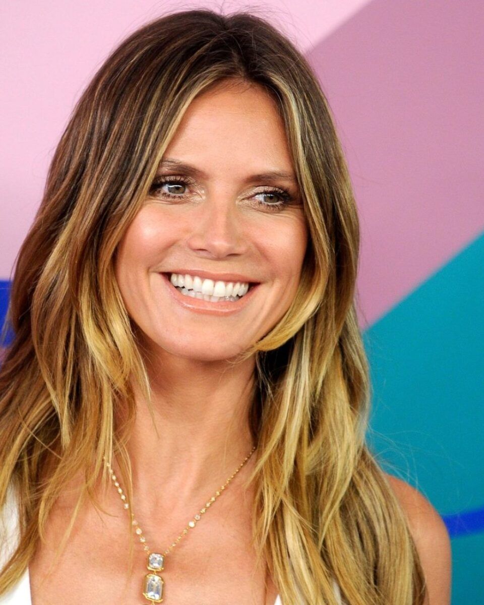 Dr. Nikola Milojević: “No trace face” – tajna dobrog izgleda Heidi Klum s 44 godine