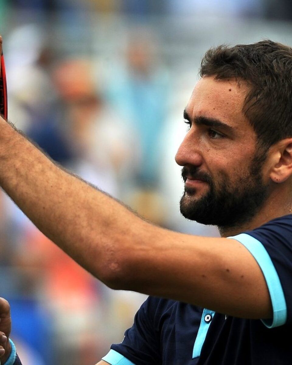 Uspješna korekcija nosa u rukama svjetski poznatog stručnjaka za plastično-rekonstruktivnu kirurgiju glave i vrata