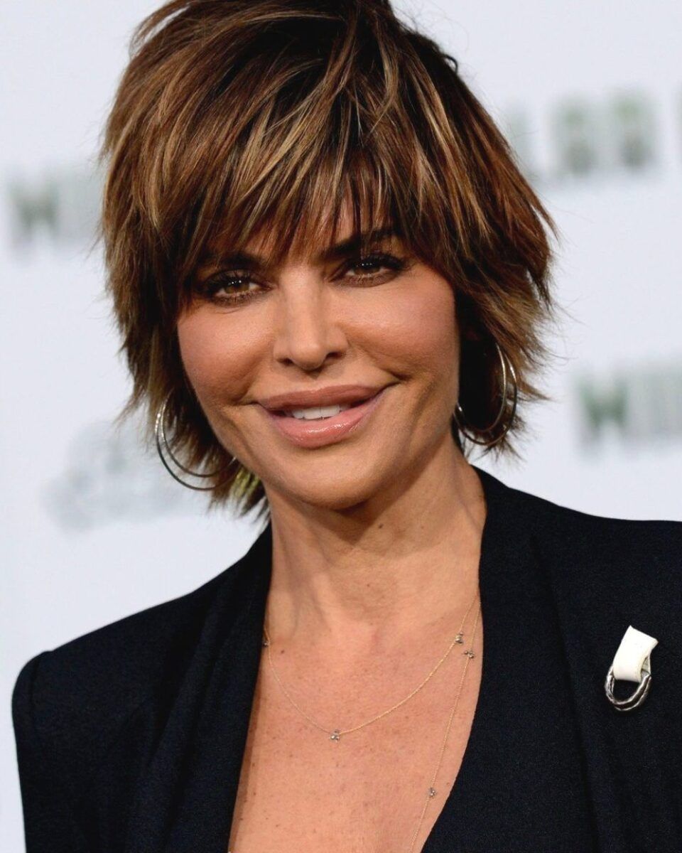 Dr. Aleksandar Milenović: “Operative look” – najveća pogreška moderne estetske medicine