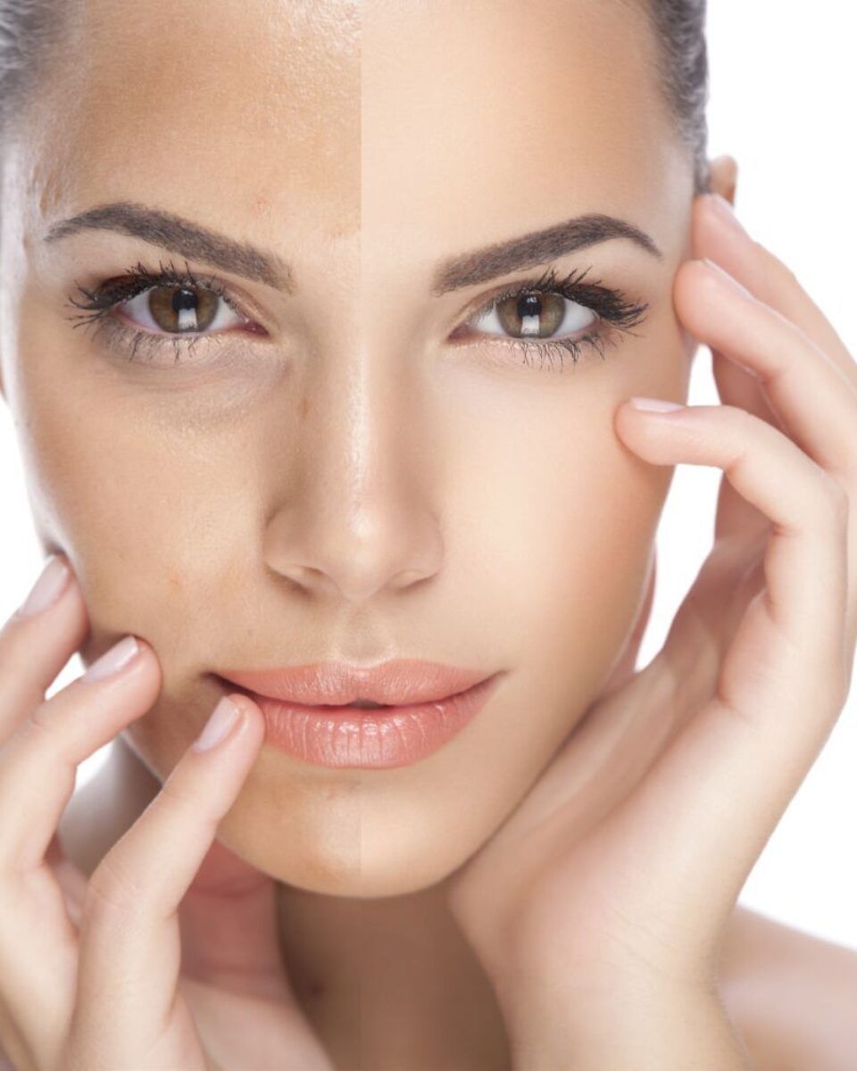 Edukacija iz područja korektivne dermatologije: Medicinski Dermaroller i e-Dermastamp