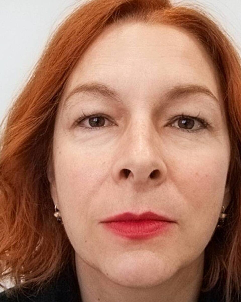 Glumica Jelena Miholjević: Sreća nakon estetske operacije kapaka