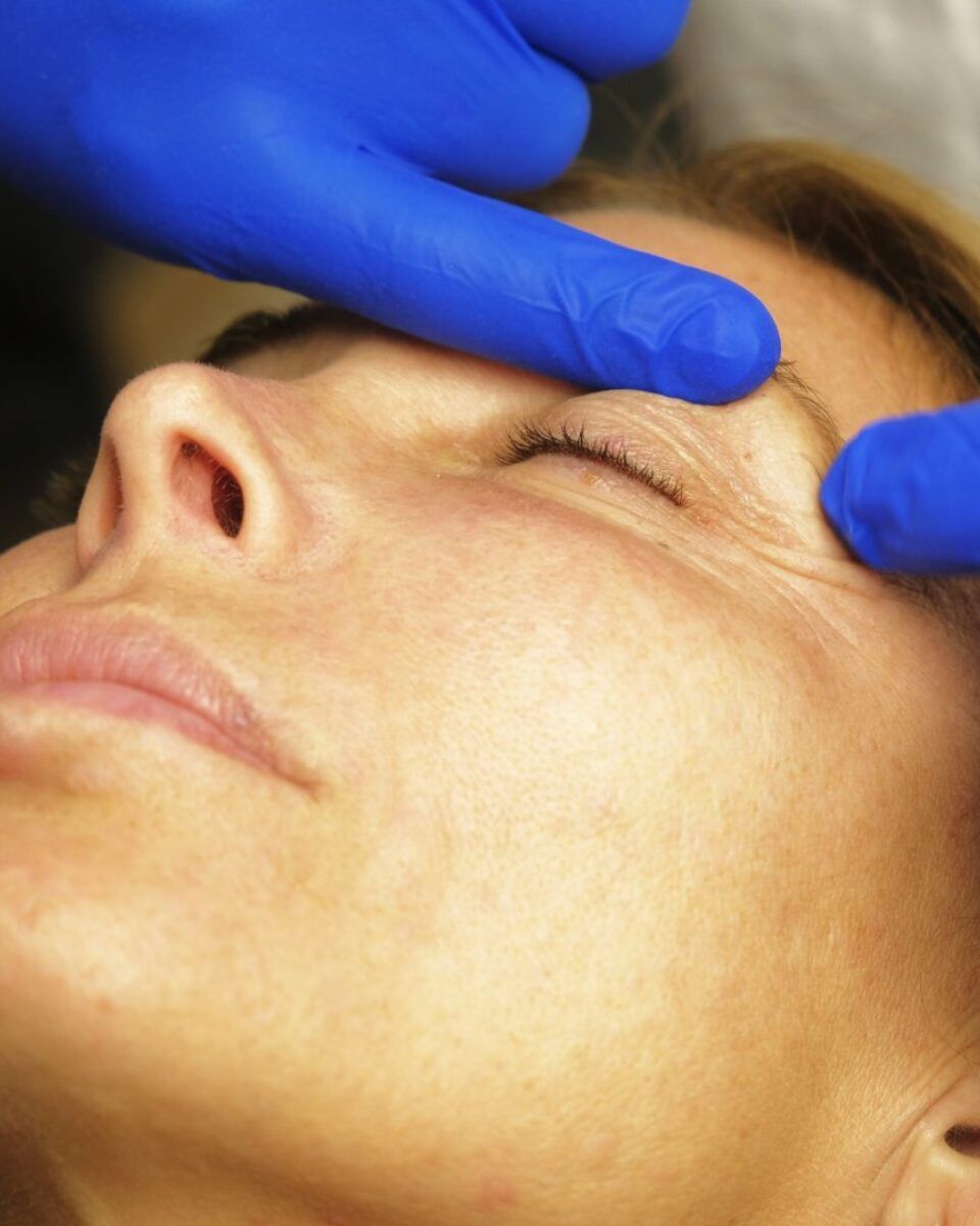 Dr. Ivana Nola: Bez operacije do zategnutih kapaka