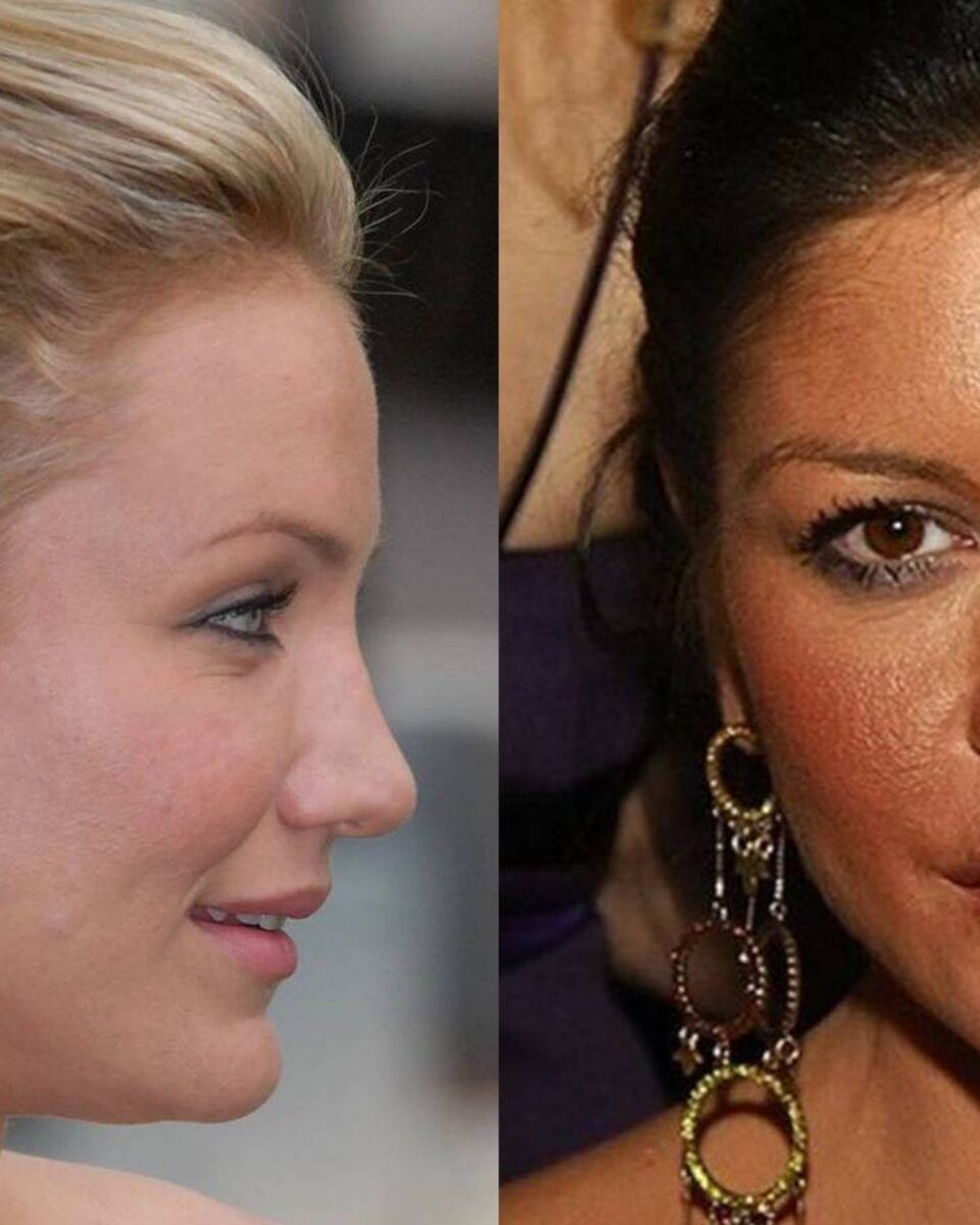 Dr. Željana Bolanča: Kako se obračunati s proširenim porama?