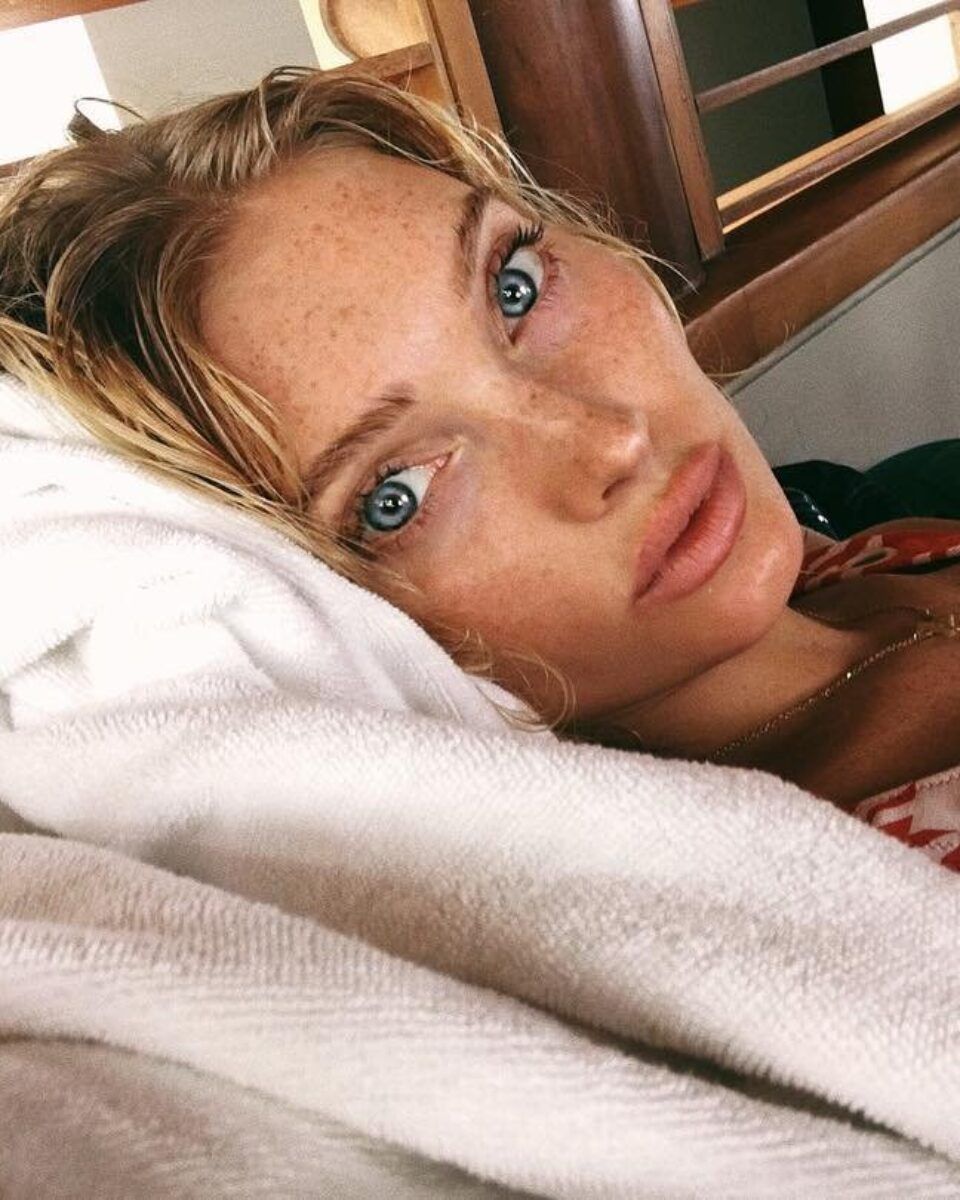 Ove bore posebno se razvijaju i produbljuju dok spavamo – što poduzeti?