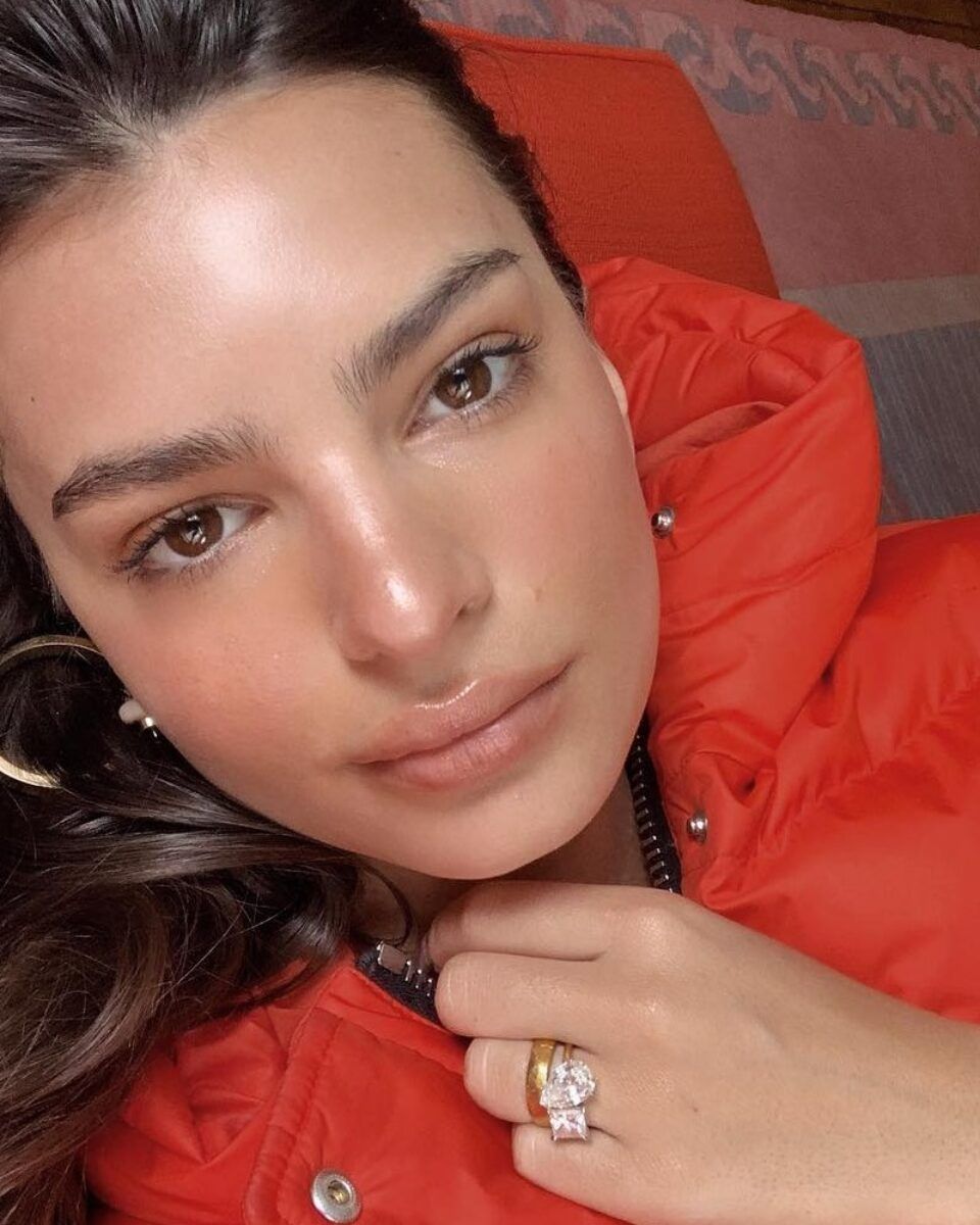 Glavni razlozi zbog kojih se zimi ten naglo pogorša