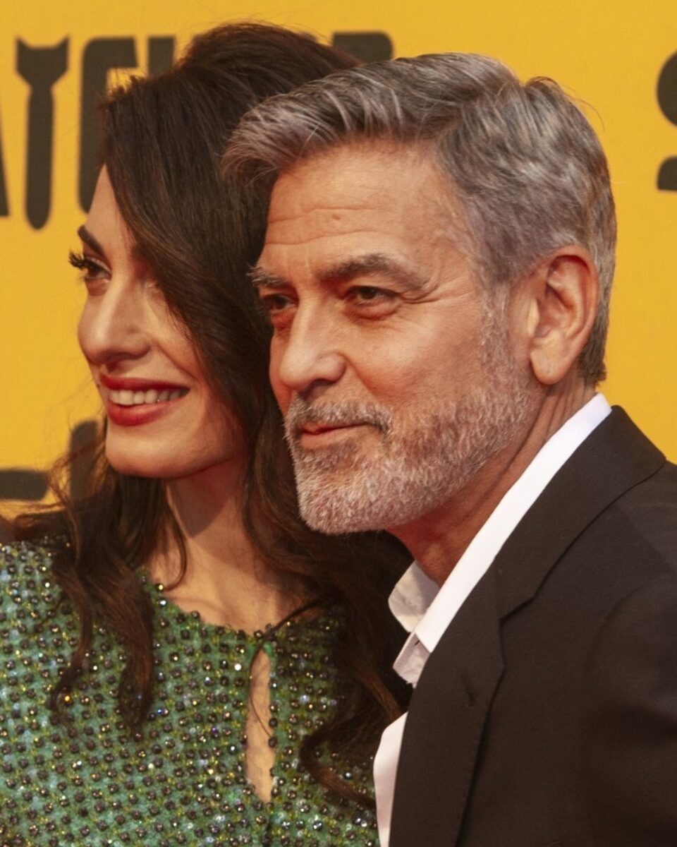 Kako izgledaju rezultati transplantacije kose, obrva i brade u rukama svjetski priznate stručnjakinje?