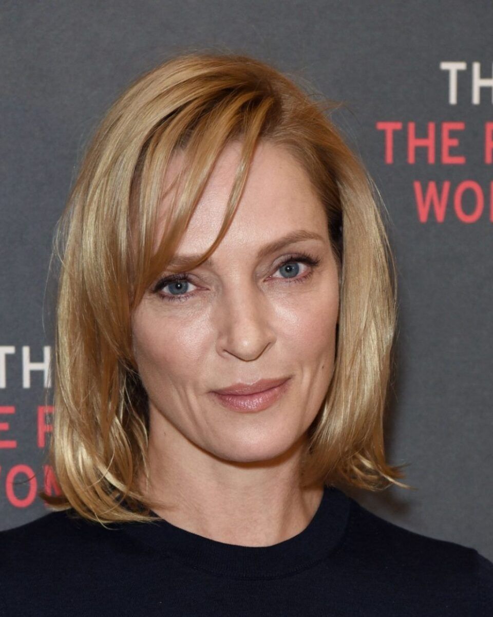 Znate li što je karboksiterapija? Tretman koji rješava bore, opuštenu kožu, strije, masne naslage, podočnjake…