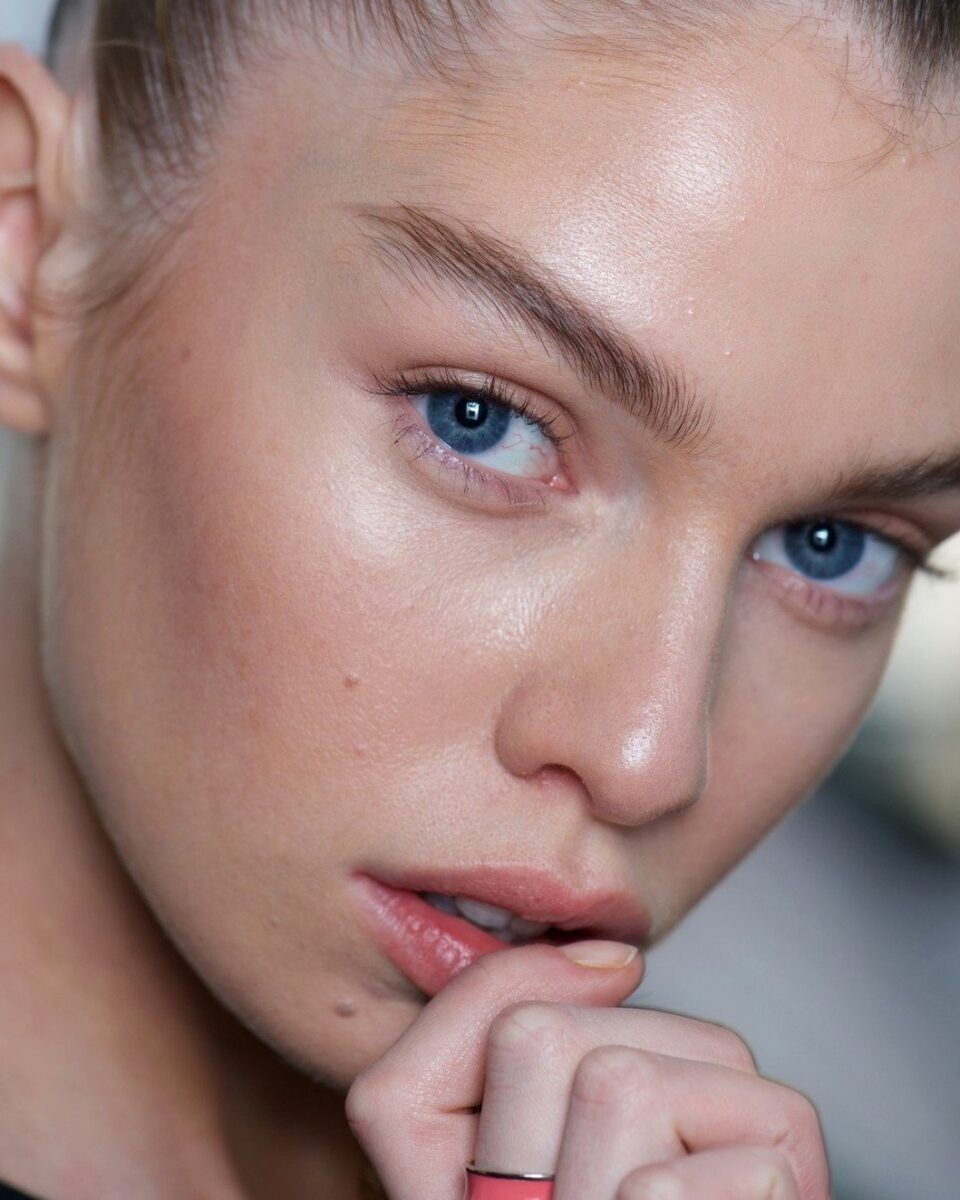 S dolaskom proljeća vratile su se i akne? Ovo su najučinkovitiji tretmani i proizvodi za vas