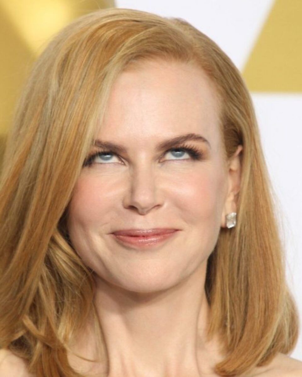 “Bad botox”: Posljedice loše apliciranog botoxa