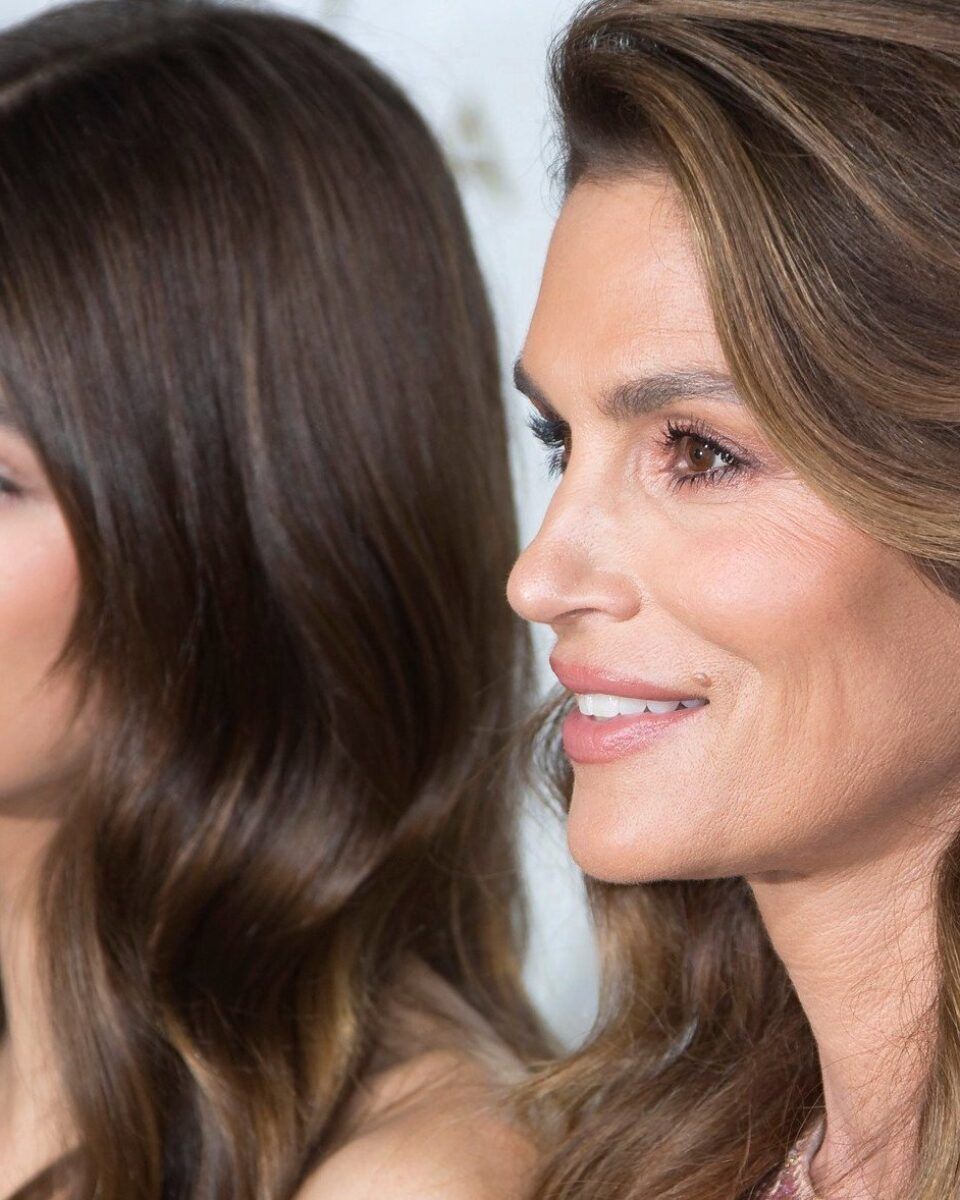 Kako starimo: promjene koje se s godinama događaju na licu