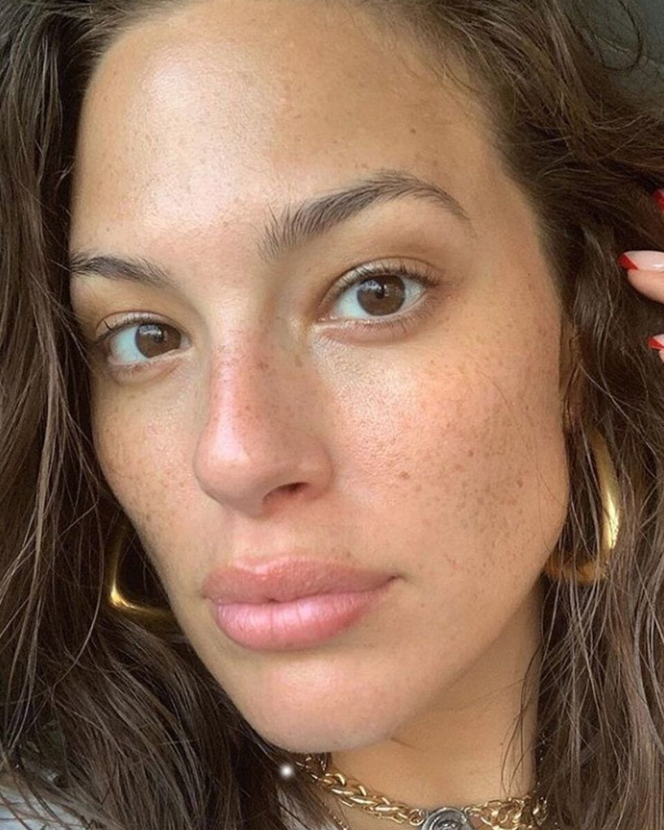 Povratak proljeća donio je i povratak hiperpigmentirane promjene na vašoj koži? Stručnjakinja otkriva idealne formule koje će ih spriječiti