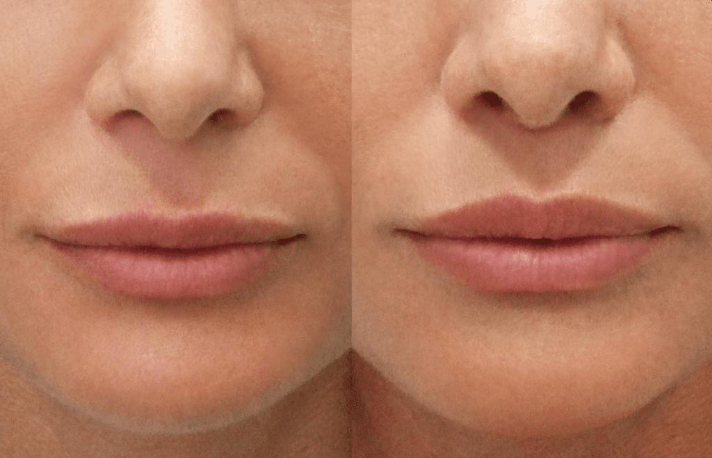 Prije i poslije. Iz arhive Poliklinika Sinteza.