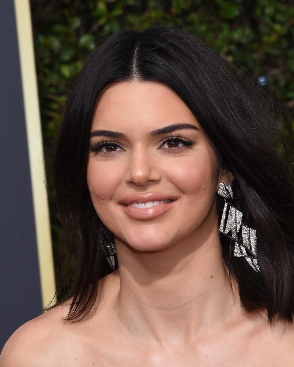 Ovo su proizvodi koje dermatolozi preporučuju kod „ozbiljnih“ akni