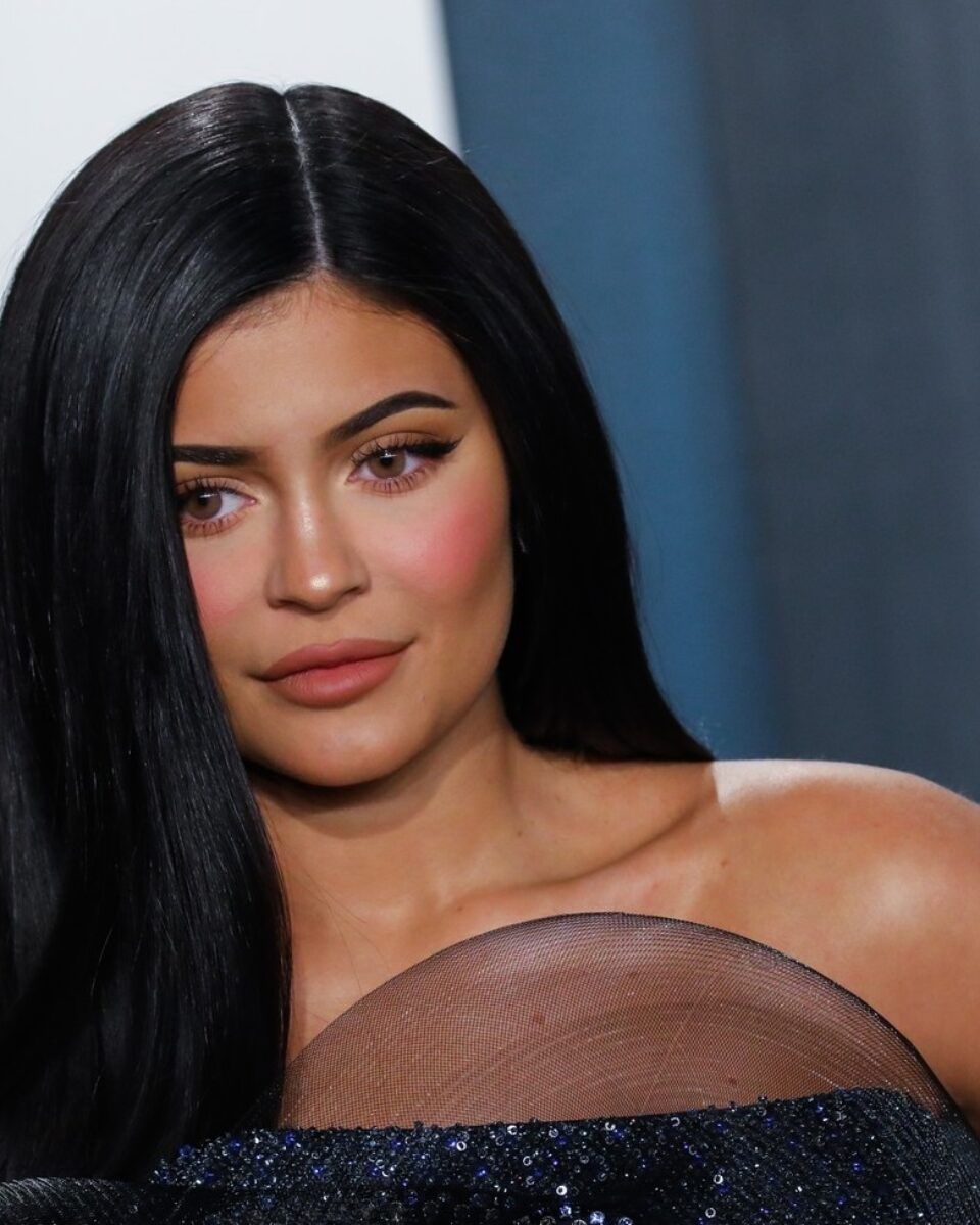 Koliko košta i koliko traje rezultat ravnanja nosa filerima?