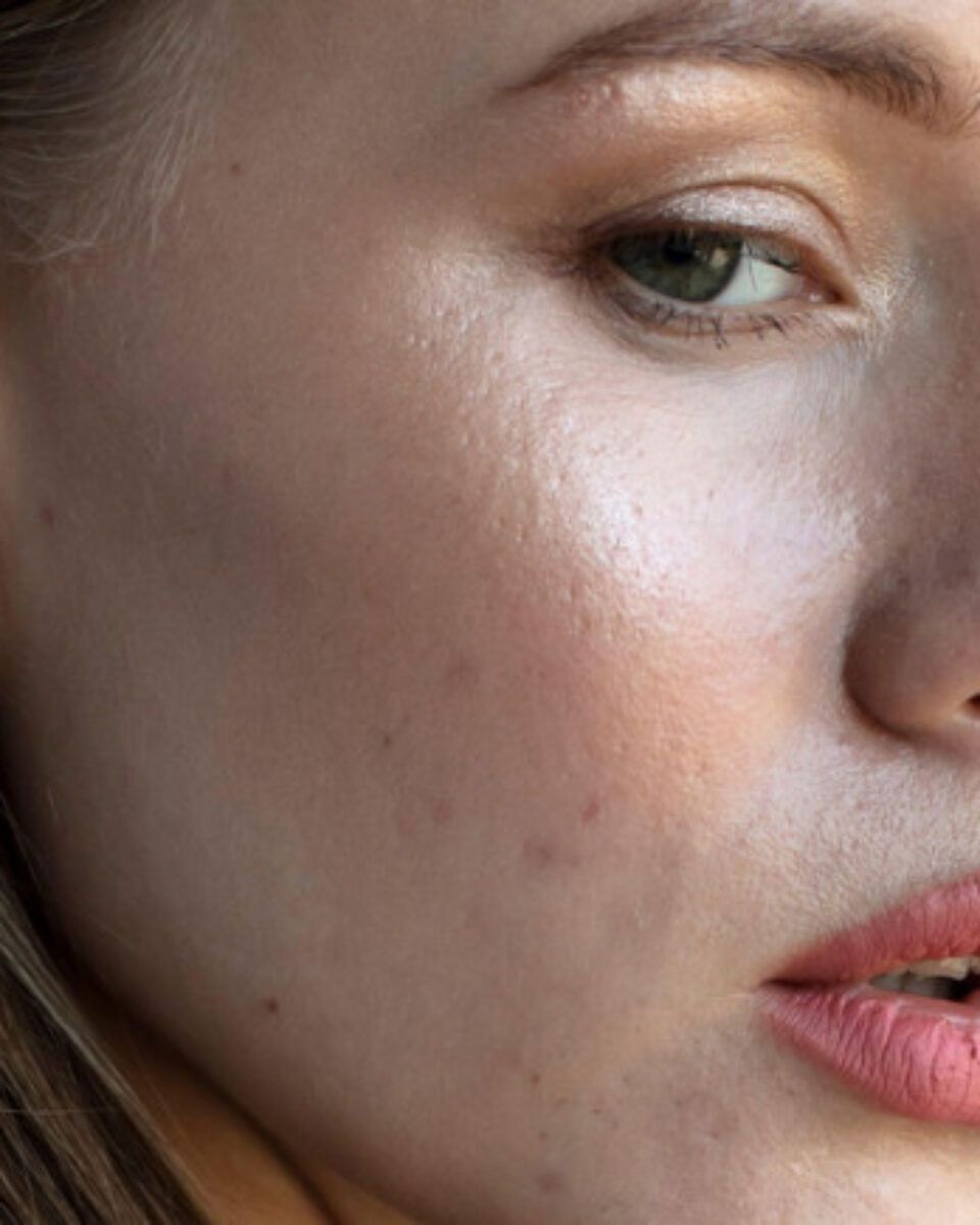 Hit renomiranog francuskog brenda: krema koja umiruje kožu za 30 sekundi