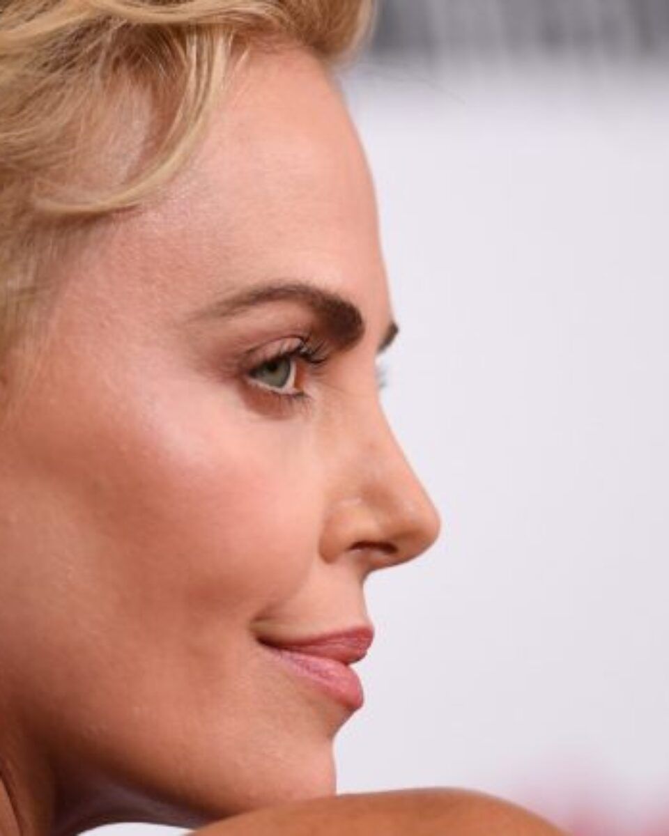 Konačno u Hrvatskoj – moćni biorevitalizacijski filer za prirodni lifting lica