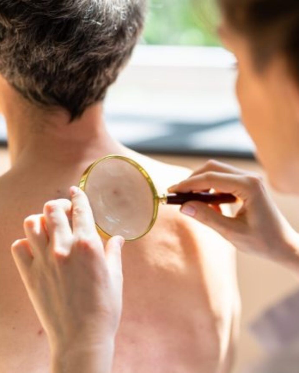 I riječki dermatolozi u akciji #pokazise