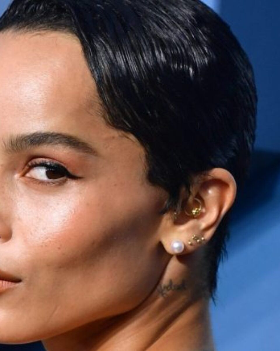 Kako spriječiti fleke od akni?