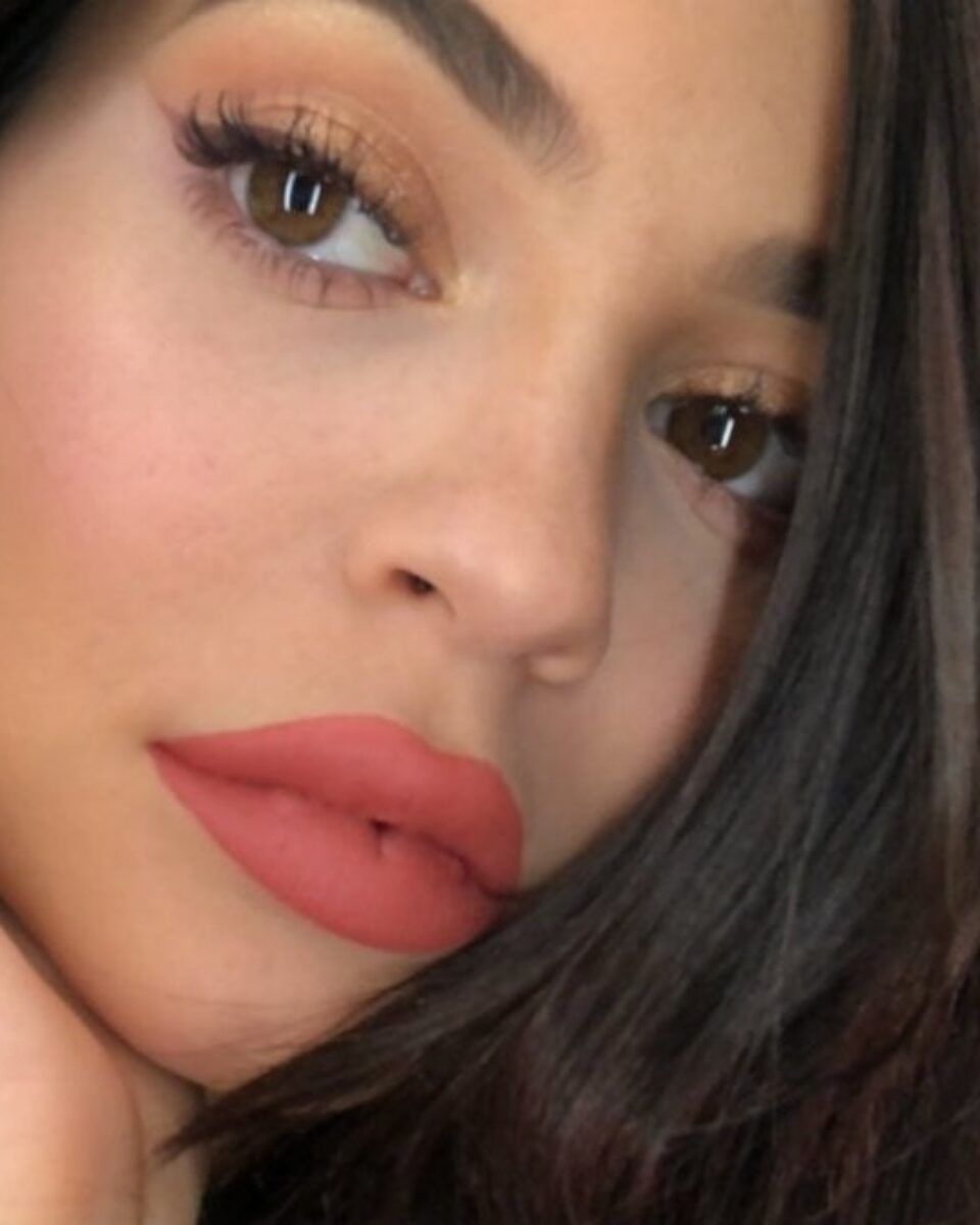 Sve o trendu ‘russian lips’ i što o njemu misle plastični kirurzi