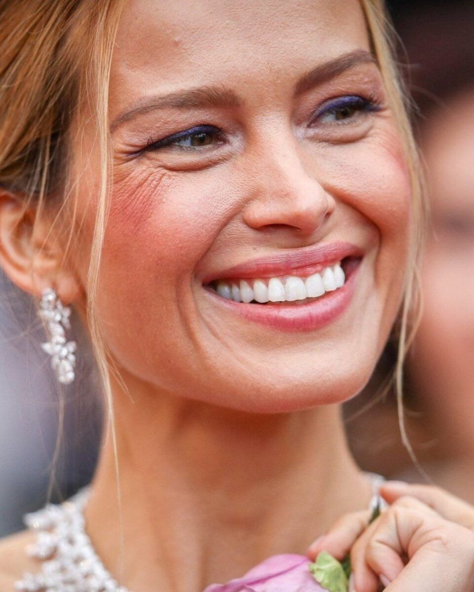 DR. SINIŠA GLUMIČIĆ: Najbolje vrijeme za facelifting je nakon 50-e