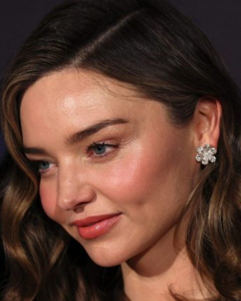 Kako se rozacea ponaša ljeti?