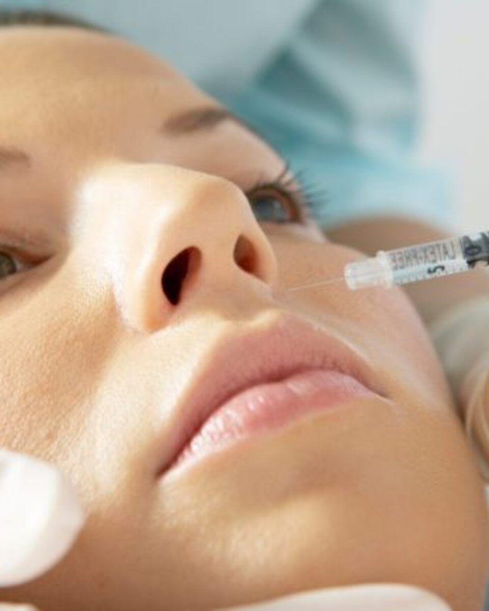 Baby botox – anti age tehnika koju obožavaju mladi