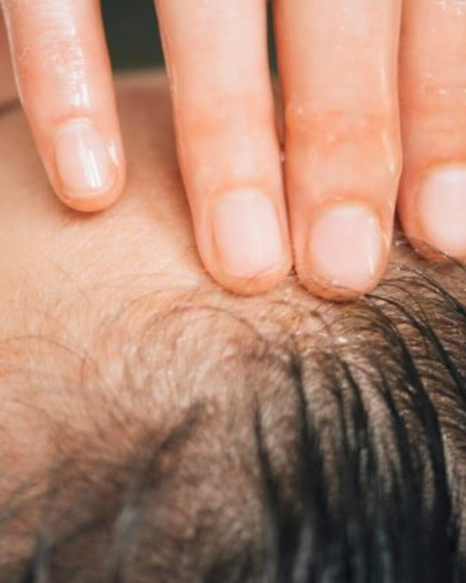 Hair oiling – povratak tradicionalne tehnike njege kose