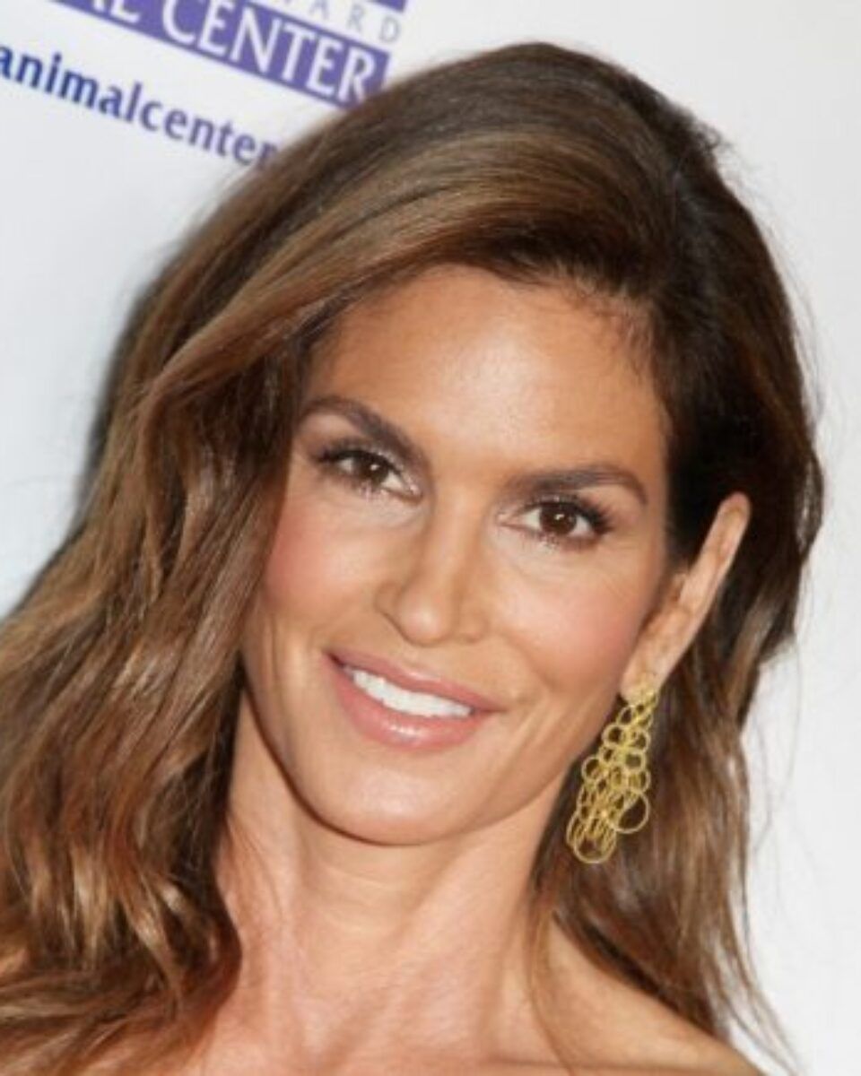 Zašto je botox još uvijek broj 1 u pomlađivanju