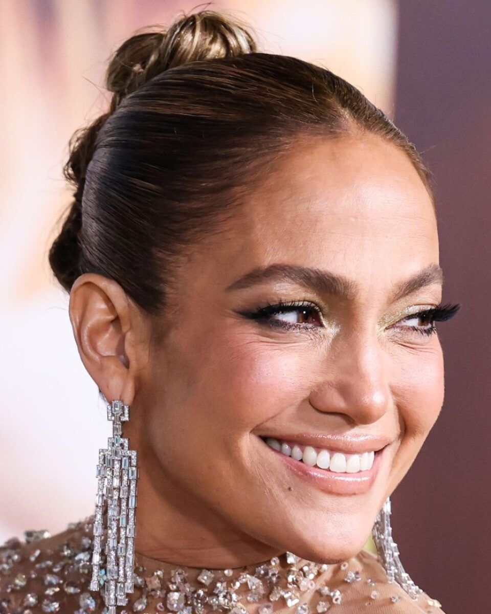 Želite botox, ali i odgovore na baš sva pitanja o tom tretmanu? Na pravoj ste adresi!