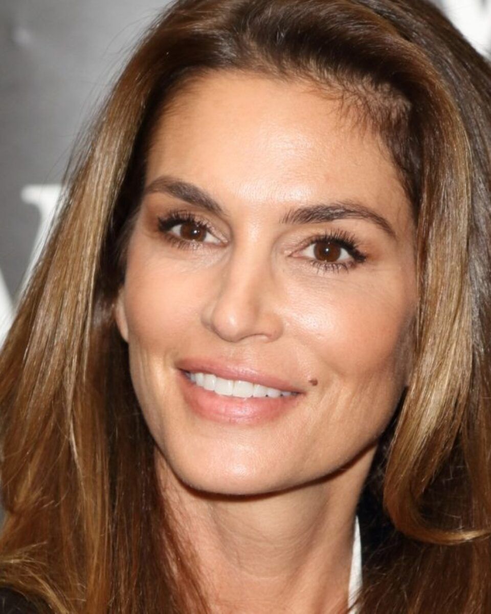 Kako prepoznati je li madež opasan? Kada treba postojati razlog za brigu?