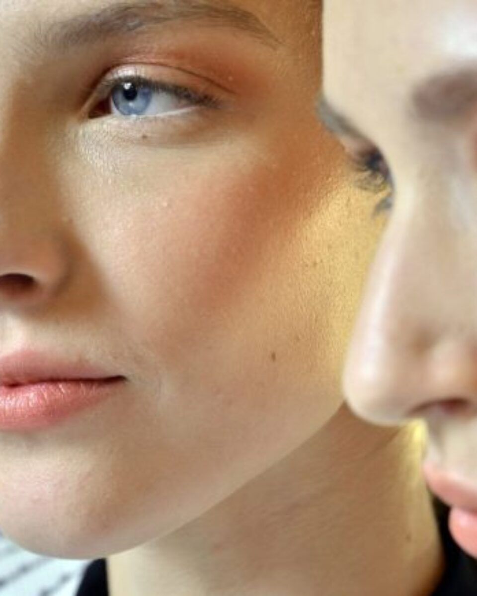 Kad koža reagira crvenilom, ova formula priskače u pomoć!