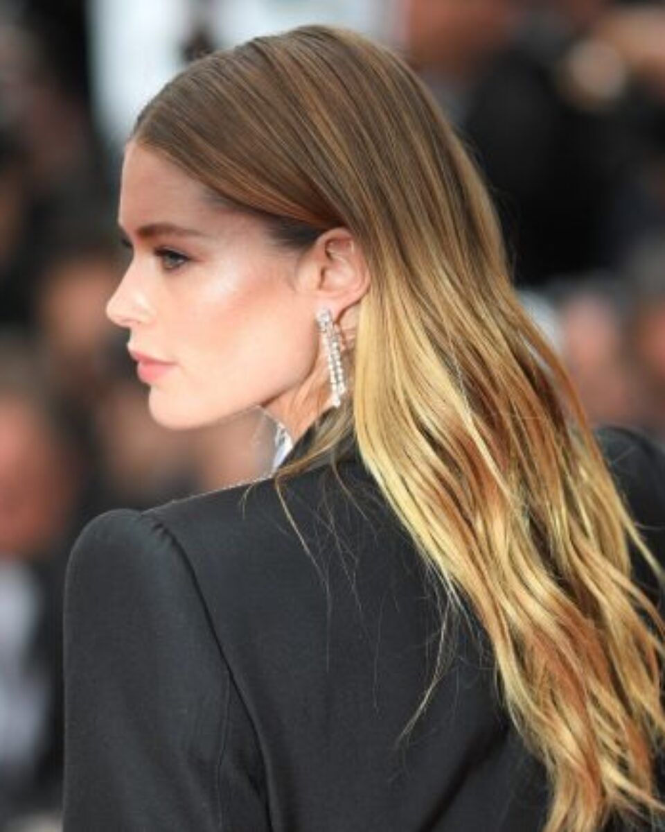 S mora ste se vratili s hiperpigmentacijama? Evo što učiniti