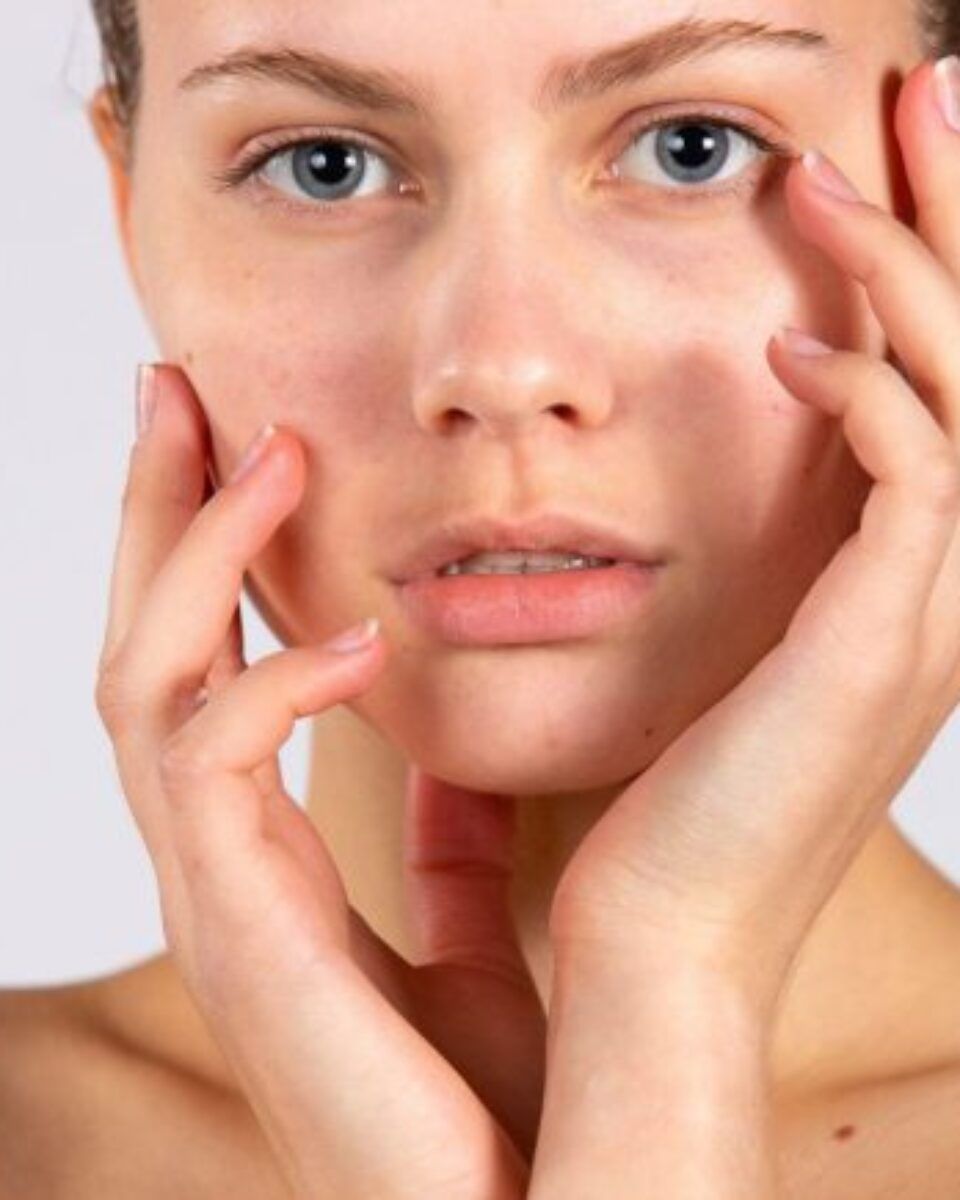 Borite li se i vi s rozacejom? Pravilnom njegom kože do poboljšanja simptoma