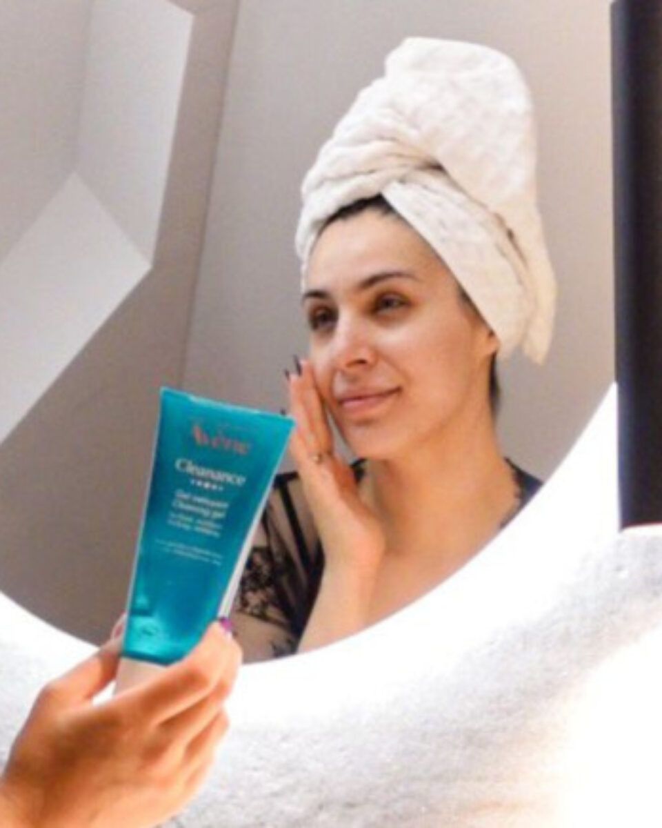 Stiže proljeće, stižu akne. Evo kako ih zaustaviti!