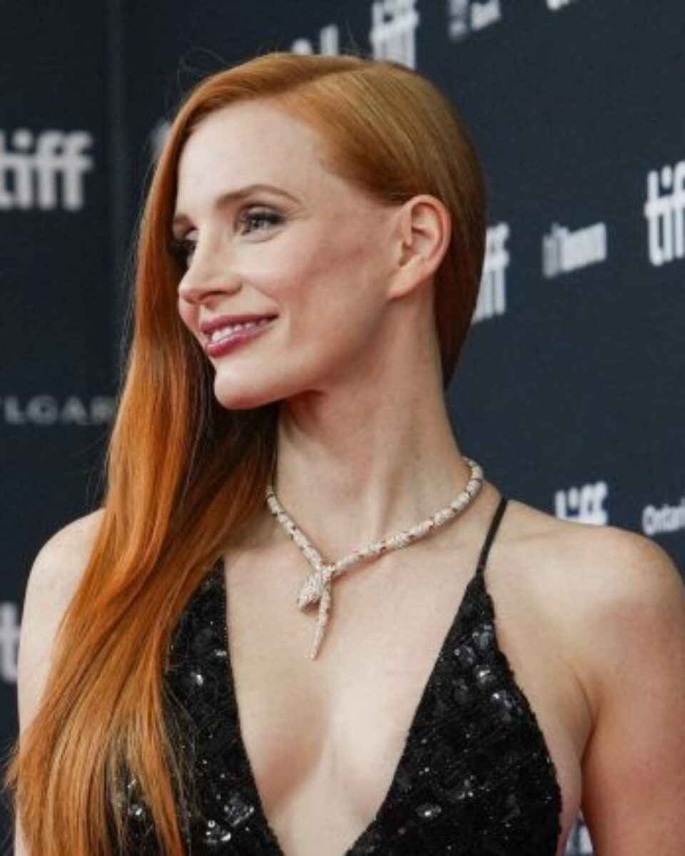 Muči vas gubitak volumena lica? Ovaj tretman naglašava jagodice i vraća punoću