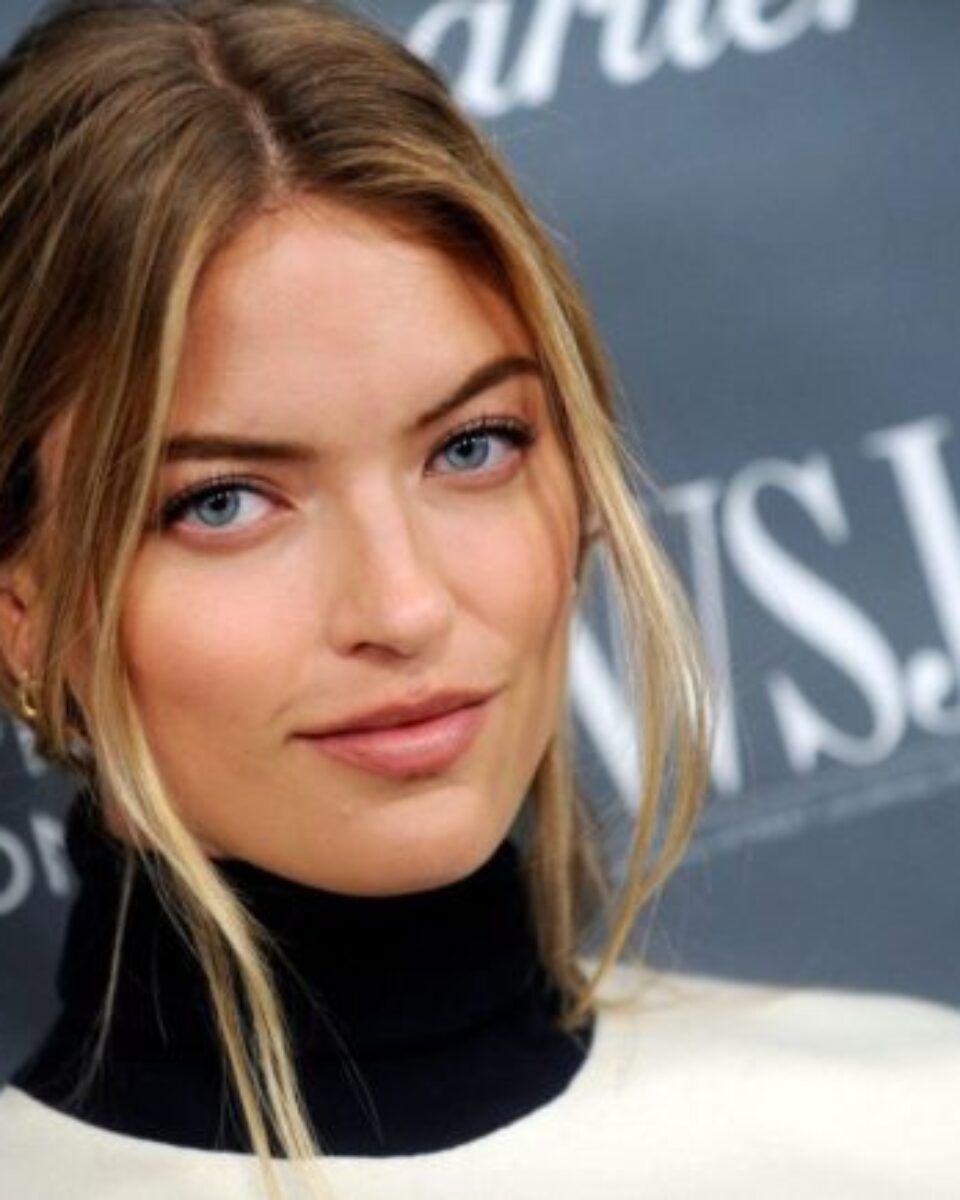 Hit zimski tretman: Baš sve što trebate znati o microneedlingu