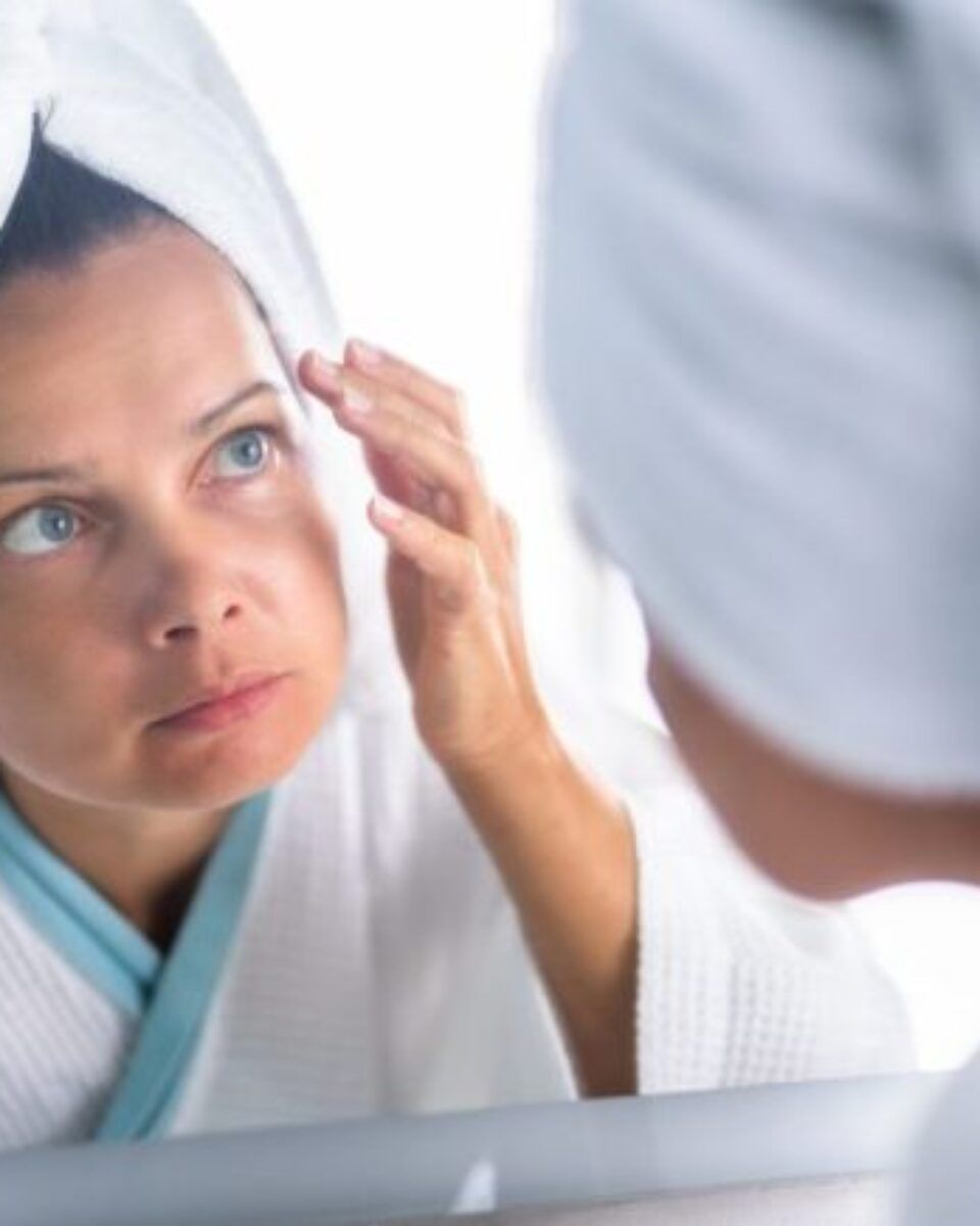 Akne u odrasloj dobi: više od estetskog problema