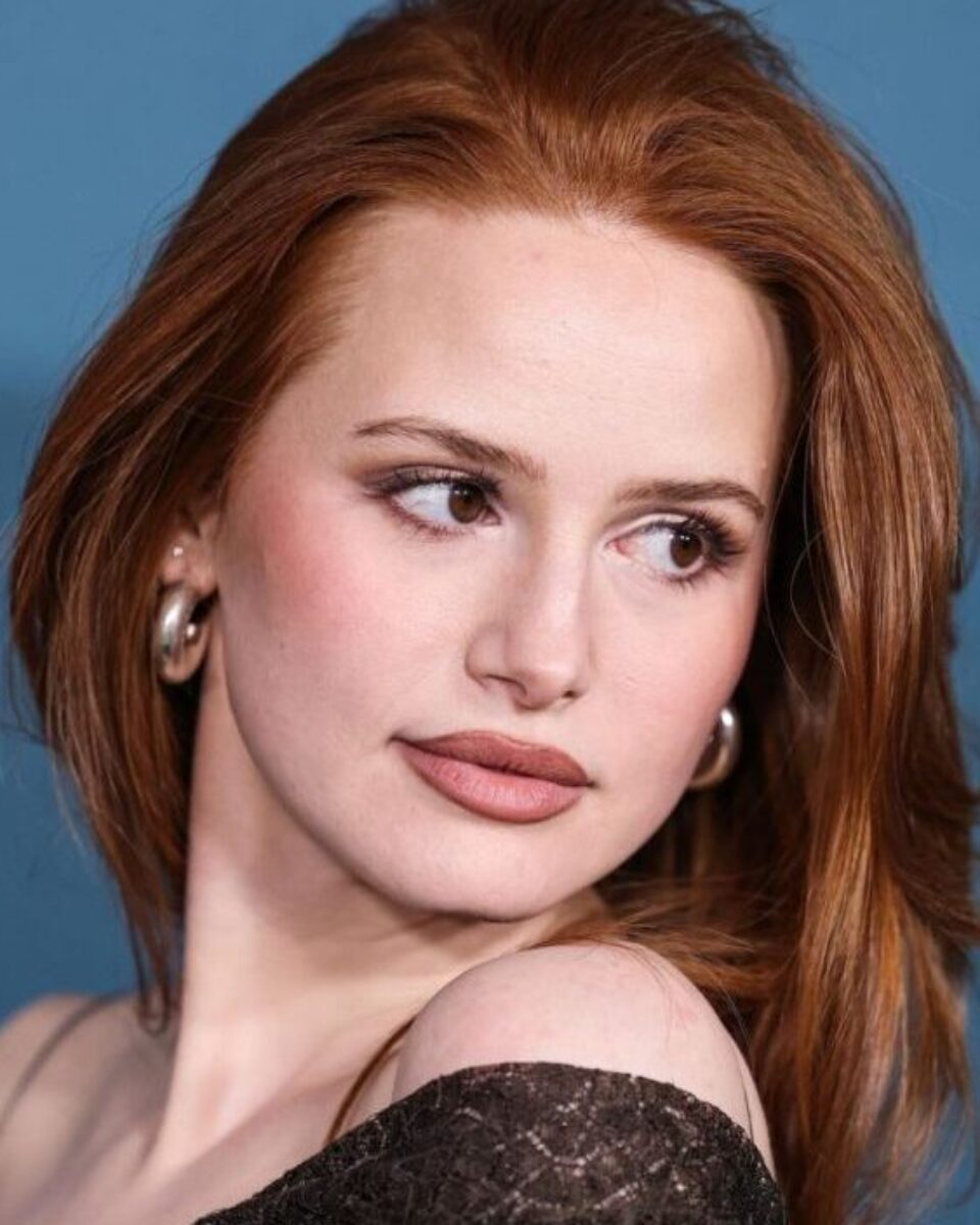 SOS hidratacija: Kako spasiti osjetljivu i oštećenu kožnu barijeru?