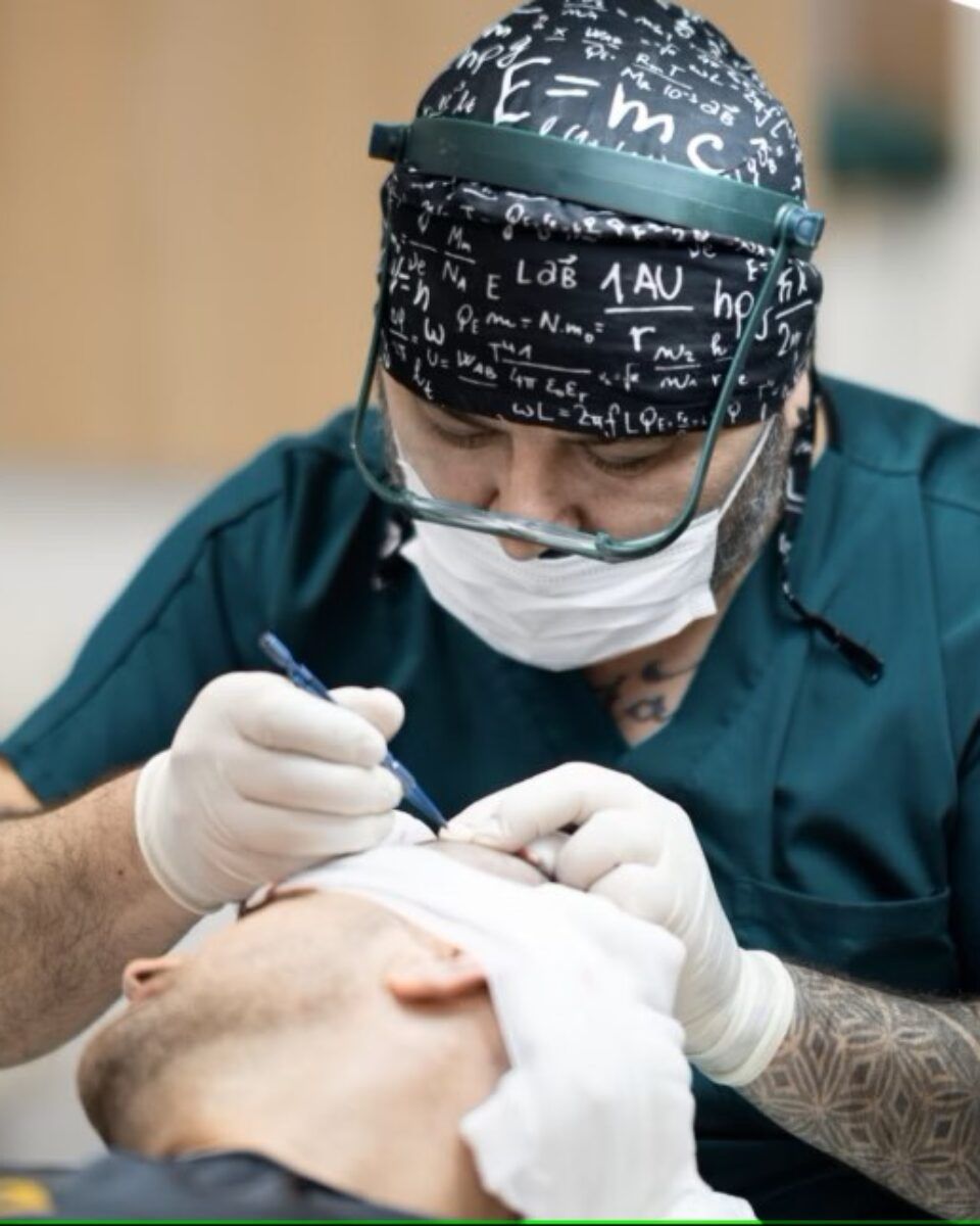 Nikad povoljnije i jednostavnije presađivanje kose