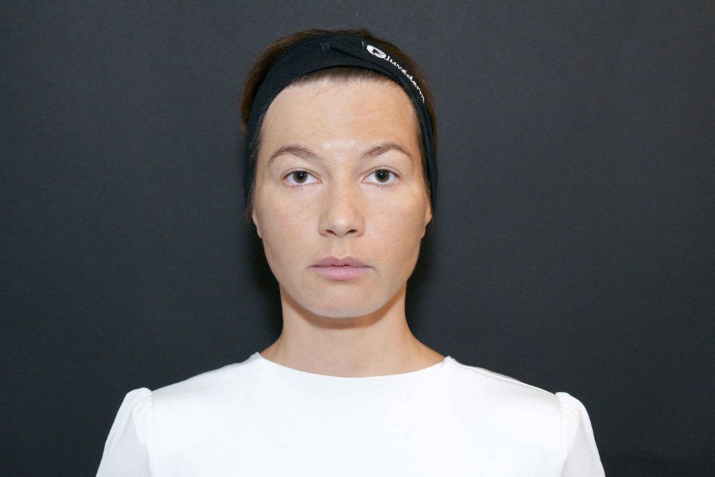 Neposredno nakon tretmana