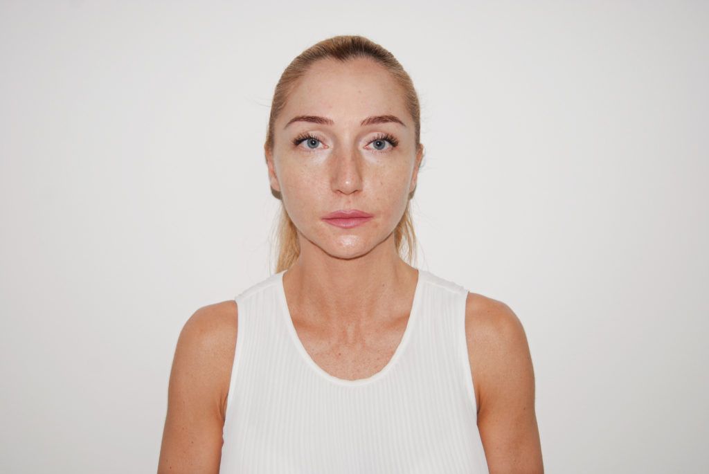 Neposredno nakon tretmana