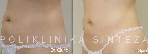 Izvor: Poliklinika Sinteza