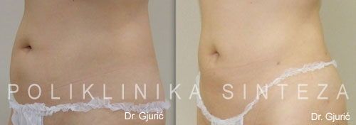 Izvor: Poliklinika Sinteza