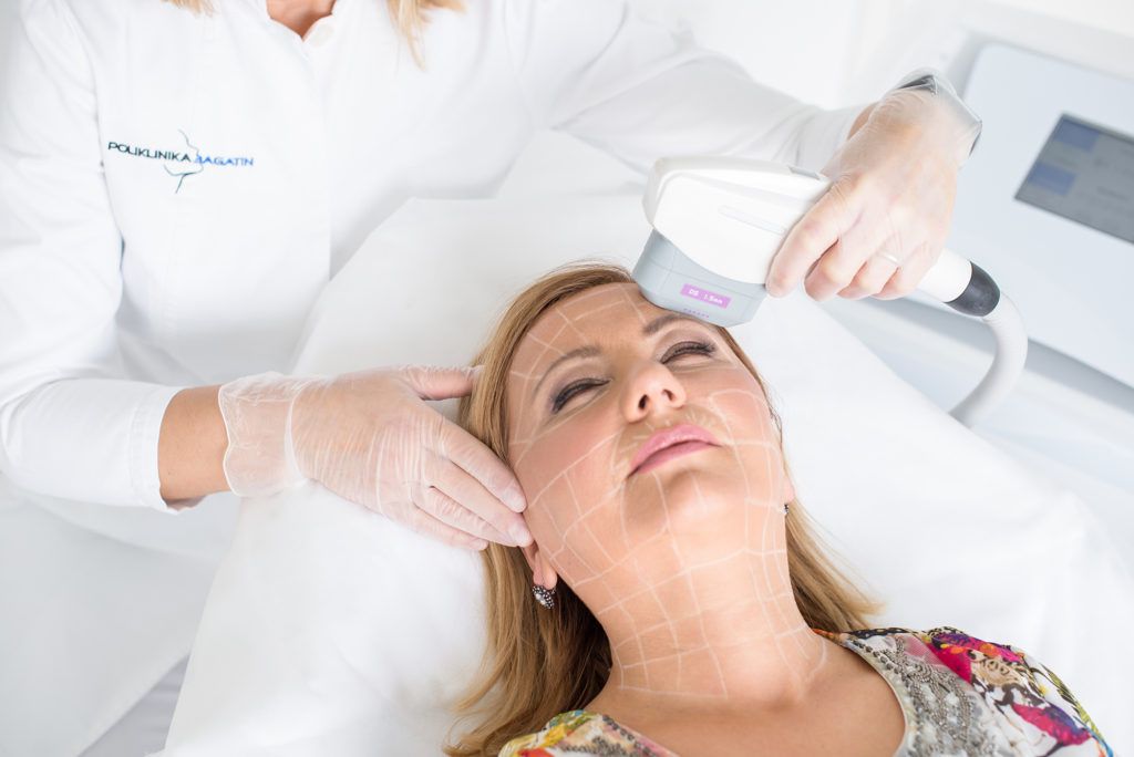 Renew lift tretman_close up tretmana na regiji cela